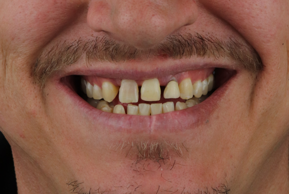 67d9f0337c24d6a7521e40cc_Before 2