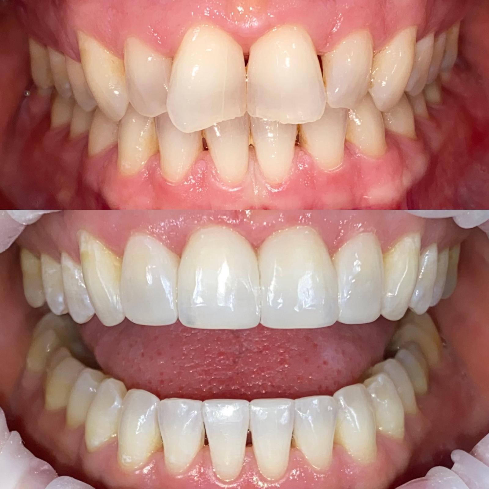 J Bell B&A12Composite Bonding