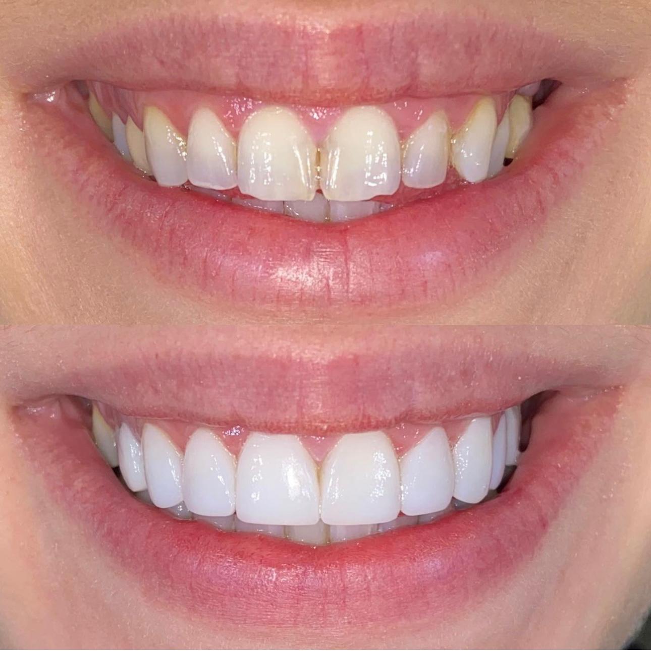 J Bell B&A3Composite Bonding