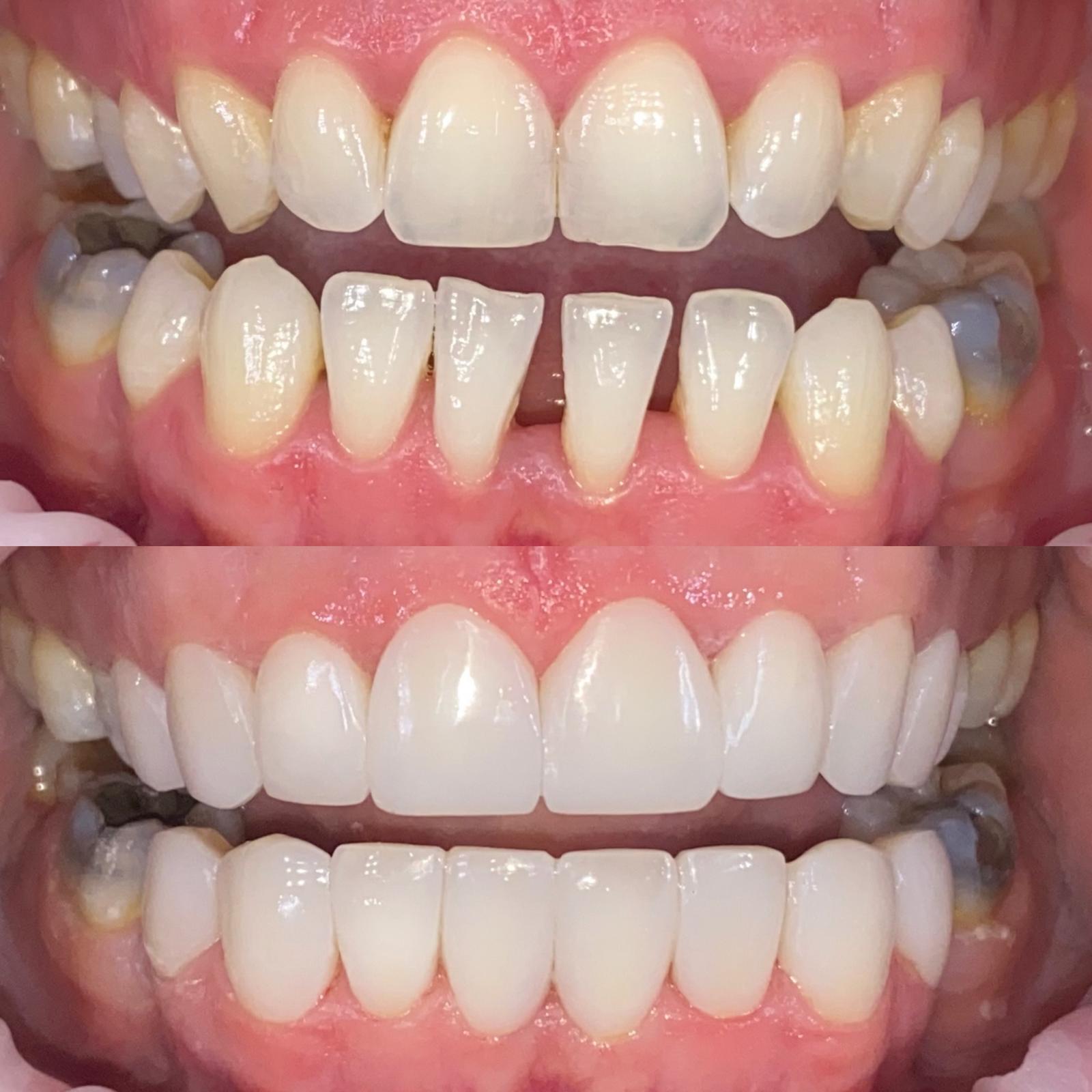 J Bell B&A9Composite Bondingx16